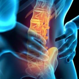 Osteochondrose: veel voorkomende oorzaken en behandeling